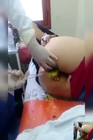 लड़की की गांड से ककड़ी निकालकर डॉक्टर ने चुदाई की अंग्रेजी बीएफ सेक्स वीडियो — screenshot 1